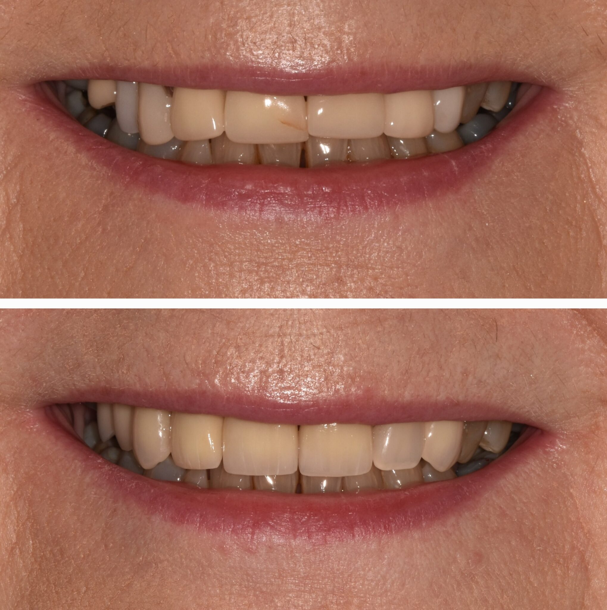 20240915_121111-2039x2048