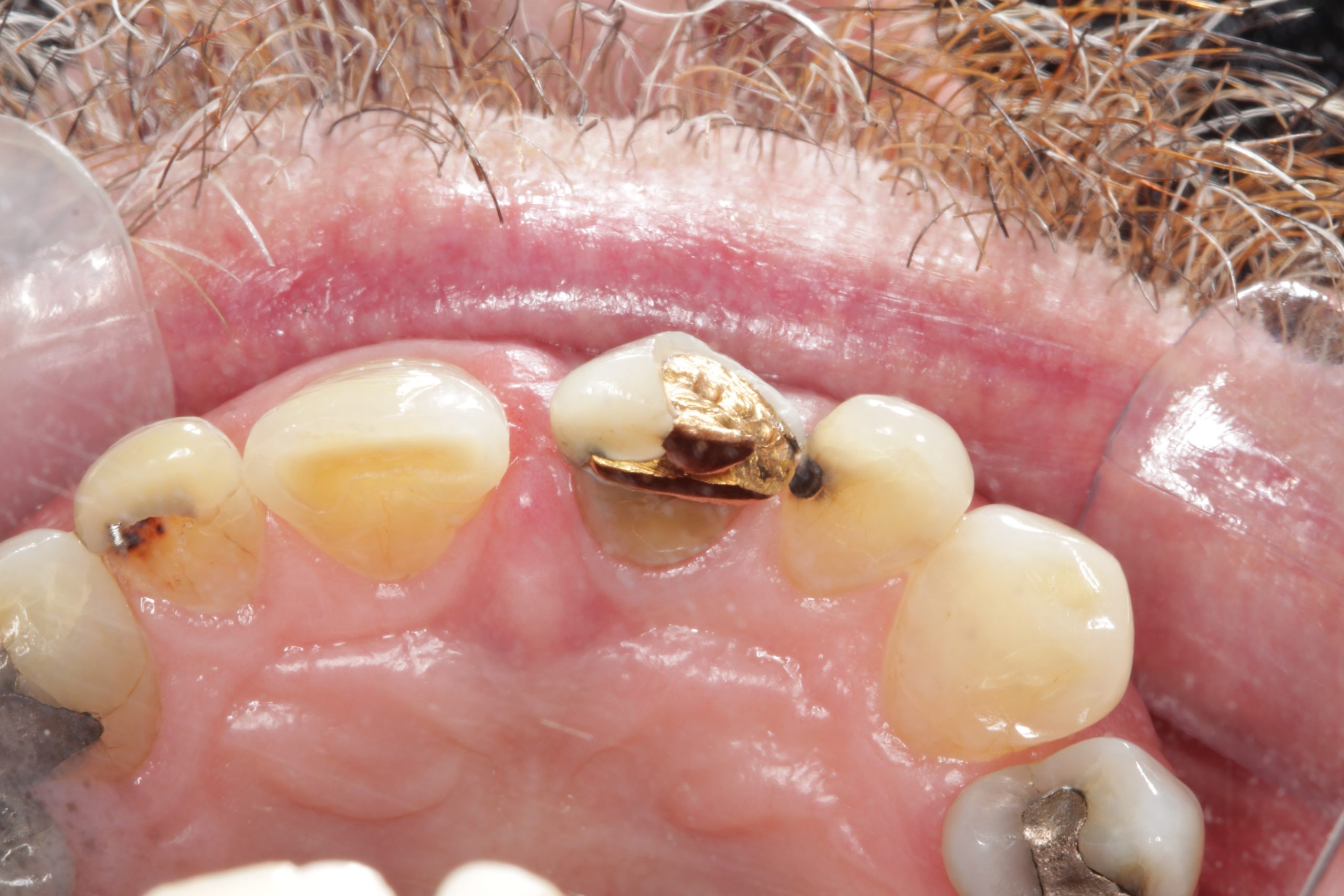 Before-Occlusal-scaled