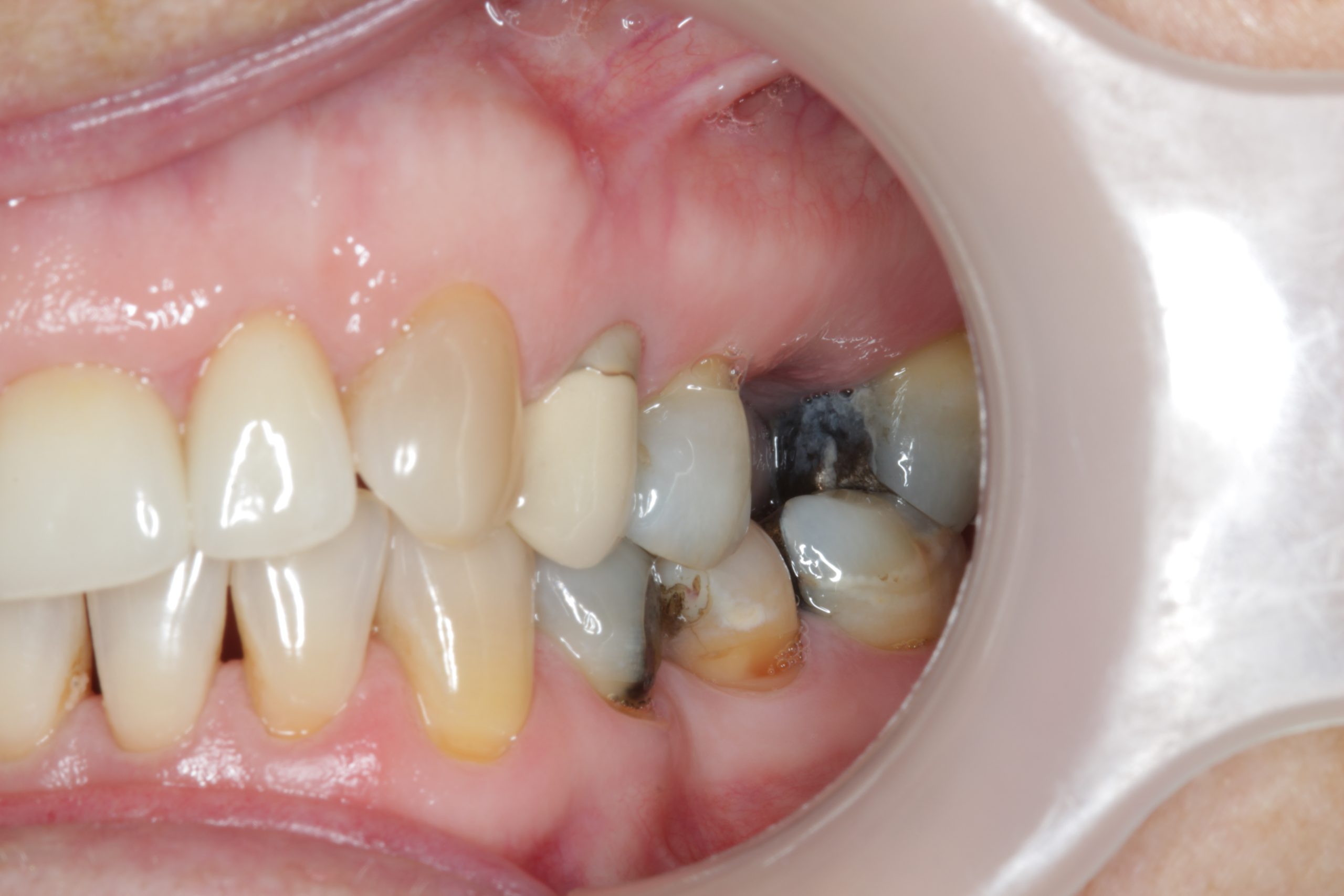 side-view-before-scaled